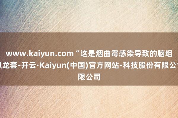 www.kaiyun.com“这是烟曲霉感染导致的脑组织龙套-开云·Kaiyun(中国)官方网站-科技股份有限公司